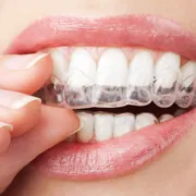 West Mill Smiles
