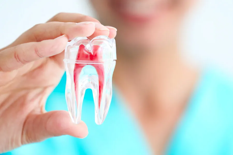 What is Root Canal Therapy?